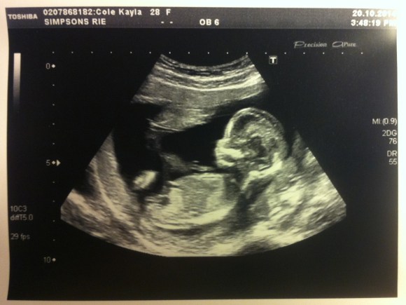 tumblr_ndretgkwUb1s4k7uro1_1280